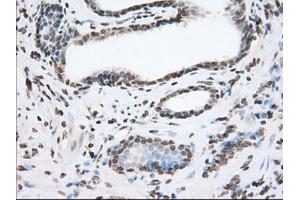 Immunohistochemical staining of paraffin-embedded Human liver tissue using anti-TACC3 mouse monoclonal antibody. (TACC3 antibody)