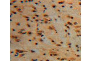Used in DAB staining on fromalin fixed paraffin-embedded brain tissue (PKC gamma antibody  (AA 351-614))