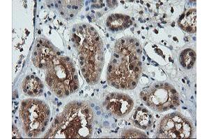 Image no. 3 for anti-Leucine Zipper and CTNNBIP1 Domain Containing (LZIC) antibody (ABIN1499239) (LZIC antibody)