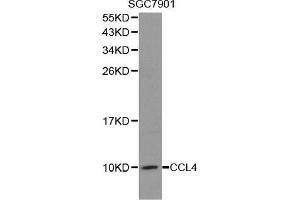Western blot analysis of extracts of SGC7901 cell lines, using CCL4 antibody. (CCL4 antibody  (C-Term))