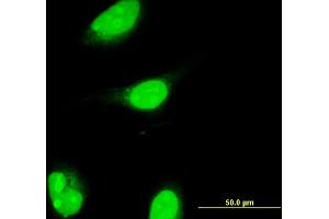 Immunofluorescence of monoclonal antibody to ALX1 on HeLa cell. (ALX1 antibody  (AA 198-306))