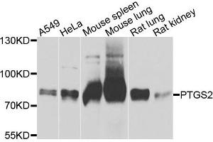 Western blot analysis of extracts of various cells, using PTGS2 antibody. (PTGS2 antibody)