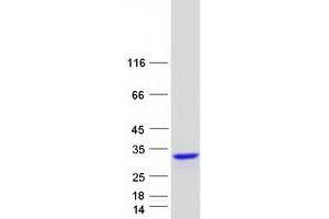 Validation with Western Blot (RGS8 Protein (Transcript Variant 1) (Myc-DYKDDDDK Tag))