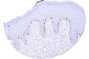 Strong PMEL immunostaining in melanocytes of the skin (Recombinant Melanoma gp100 antibody)