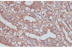 Immunohistochemistry of paraffin-embedded Rat ovary using MOB4 Polyclonal Antibody at dilution of 1:100 (40x lens). (MOBKL3 antibody)
