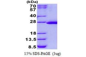 Image no. 1 for FtsJ RNA Methyltransferase Homolog 2 (FTSJ2) protein (His tag) (ABIN1098388)