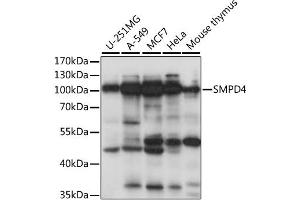 Western blot analysis of extracts of various cell lines, using SMPD4 antibody (ABIN6291650) at 1:1000 dilution.