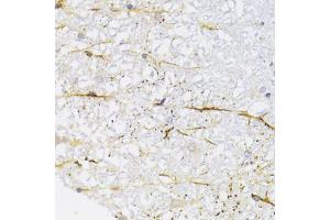 Immunohistochemistry of paraffin-embedded rat spinal cord using KIF1B Antibody (ABIN2563552) at dilution of 1:100 (40x lens). (KIF1B antibody)