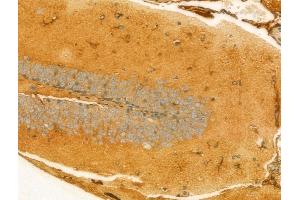 ABIN6265901 and ABIN6273084 at 1/100 staining Mouse brain tissue by IHC-P.