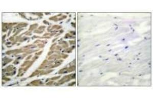 Immunohistochemical analysis of paraffin-embedded human heart tissue using Sodium Channel-pan antibody. (SCN5A antibody)