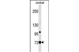 LCP1 Antibody (Center) (ABIN1538283 and ABIN2850258) western blot analysis in Jurkat cell line lysates (35 μg/lane). (LCP1 antibody  (AA 306-335))