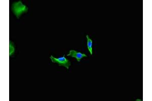 Immunofluorescent analysis of Hela cells using ABIN7152932 at dilution of 1:100 and Alexa Fluor 488-congugated AffiniPure Goat Anti-Rabbit IgG(H+L) (Fidgetin antibody  (AA 132-371))