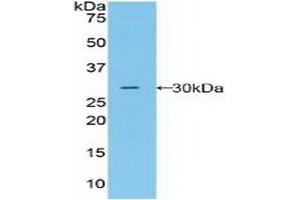 Detection of Recombinant MST1R, Human using Polyclonal Antibody to Macrophage Stimulating 1 Receptor (MST1R) (MST1R antibody  (AA 1092-1316))