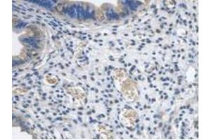 IHC-P analysis of Mouse Uterus Tissue, with DAB staining. (PCYOX1 antibody  (AA 249-505))