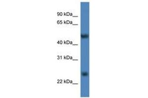 Image no. 1 for anti-Methyltransferase Like 4 (METTL4) (AA 361-410) antibody (ABIN6746295) (METTL4 antibody  (AA 361-410))
