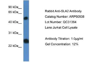 WB Suggested Anti-SLA2  Antibody Titration: 0. (SLAP2 antibody  (N-Term))