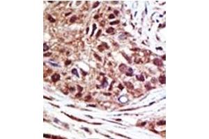 Image no. 1 for anti-Ubiquitin Specific Peptidase 14 (USP14) (N-Term) antibody (ABIN357546) (USP14 antibody  (N-Term))