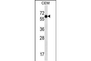 Western blot analysis in CEM cell line lysates (35ug/lane). (TFAP2B antibody  (C-Term))
