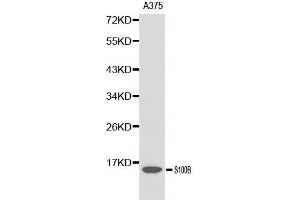 Western blot analysis of A375 cell lysate using S100B antibody.