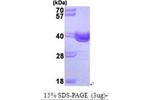 SDS-PAGE (SDS) image for Small Glutamine-Rich Tetratricopeptide Repeat (TPR)-Containing, alpha (SGTA) (AA 1-313) protein (His tag) (ABIN666980) (SGTA Protein (AA 1-313) (His tag))