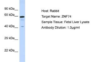 Host: Rabbit Target Name: ZNF74 Sample Tissue: Human Fetal Liver Antibody Dilution: 1ug/ml