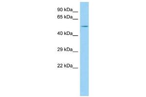 Host: Rabbit Target Name: GPRIN2 Sample Type: MDA-MB-435S Whole Cell lysates Antibody Dilution: 1. (GPRIN2 antibody  (N-Term))