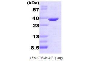 Figure annotation denotes ug of protein loaded and % gel used. (AKR1B1 Protein (AA 1-316))