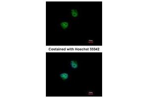 ICC/IF Image Immunofluorescence analysis of paraformaldehyde-fixed HeLa, using S6K2, antibody at 1:500 dilution. (RPS6KB2 antibody  (Center))
