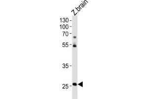 Western Blotting (WB) image for anti-Homeobox C4 (HOXC4) antibody (ABIN3004626)