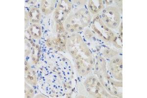 Immunohistochemistry of paraffin-embedded rat kidney using UBE3A antibody. (ube3a antibody  (AA 300-590))