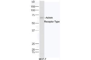 Human MCF-7 cell lysates probed with Rabbit Anti-ACVR2B/ACTR-IIB Polyclonal Antibody, Unconjugated  at 1:5000 for 90 min at 37˚C. (ACVR2B antibody  (AA 45-150))