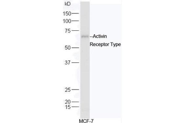 ACVR2B anticorps  (AA 45-150)