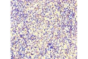Immunohistochemistry of paraffin-embedded human spleen tissue using ABIN7150361 at dilution of 1:100 (IKZF1 antibody  (AA 1-265))