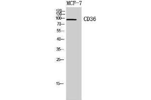 Western Blotting (WB) image for anti-CD36 (CD36) (Internal Region) antibody (ABIN3188017) (CD36 antibody  (Internal Region))
