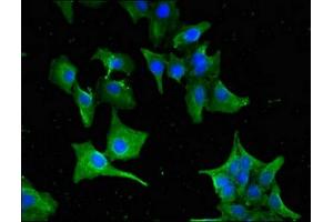 Immunofluorescent analysis of Hela cells using ABIN7154711 at dilution of 1:100 and Alexa Fluor 488-congugated AffiniPure Goat Anti-Rabbit IgG(H+L) (GNAT1 antibody  (AA 92-170))