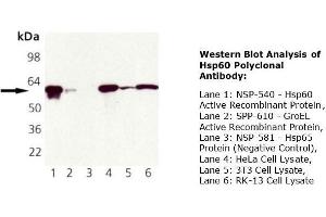 Western Blotting (WB) image for anti-Heat Shock 60kDa Protein 1 (Chaperonin) (HSPD1) antibody (ABIN615267) (HSPD1 antibody)