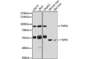 Western blot analysis of extracts of various cell lines using TMPO Polyclonal Antibody at dilution of 1:1000.