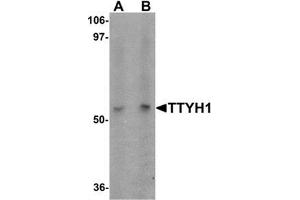 Western blot analysis of TTYH1 in Raji cell lysate with TTYH1 antibody at (A) 1 and (B) 2 ug/mL. (TTYH1 antibody  (C-Term))