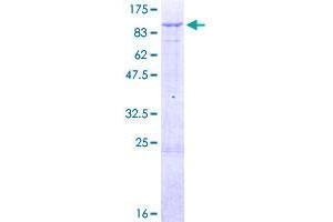 Midline 2 Protein (MID2) (AA 1-685) (GST tag)