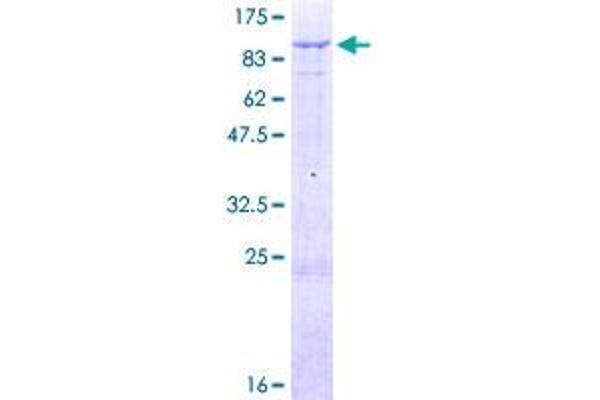 Midline 2 Protein (MID2) (AA 1-685) (GST tag)