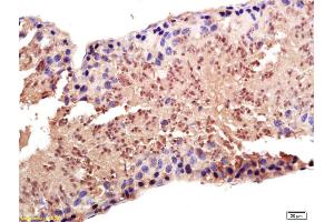 Formalin-fixed and paraffin embedded rat testis labeled with Anti-PAPOG Polyclonal Antibody, Unconjugated (ABIN1714858) at 1:200 followed by conjugation to the secondary antibody and DAB staining. (PAPOLG antibody  (AA 101-200))