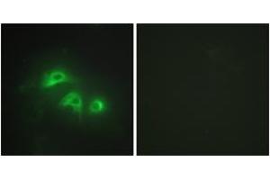 Immunofluorescence analysis of HepG2 cells, using KAD1 Antibody . (Adenylate Kinase 1 antibody  (AA 101-150))
