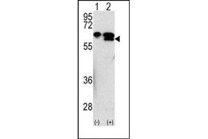 Image no. 1 for anti-Matrix Metallopeptidase 3 (Stromelysin 1, Progelatinase) (MMP3) (Middle Region) antibody (ABIN358700)