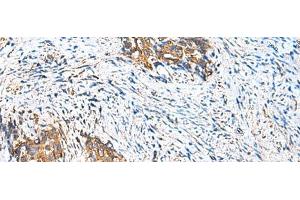 CAMSAP3 antibody