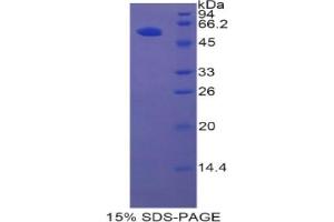 SDS-PAGE analysis of Rat HGFAC Protein. (HGFA Protein)