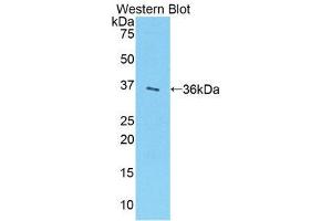 Western Blotting (WB) image for anti-Sulfotransferase Family, Cytosolic, 1A, Phenol-Preferring, Member 1 (SULT1A1) (AA 3-291) antibody (ABIN1860345)