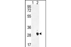 Western blot analysis of CSH1 (arrow) using rabbit polyclonal CSH1 Antibody (C-term) (ABIN654883 and ABIN2844537).