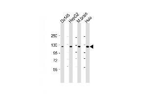 Lane 1: Du145, Lane 2: HepG2, Lane 3: mouse brain, Lane 4: Hela cell lysate at 20 µg per lane, probed with bsm-51347M DAB2IP (1626CT702. (DAB2IP antibody)