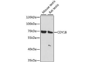 Western blot analysis of extracts of various cell lines, using CDY1B antibody (ABIN6293284) at 1:1000 dilution.