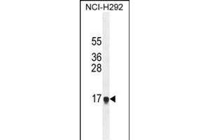 HEPN1 Antibody (N-term) (ABIN654808 and ABIN2844482) western blot analysis in NCI- cell line lysates (35 μg/lane). (HEPN1 antibody  (N-Term))
